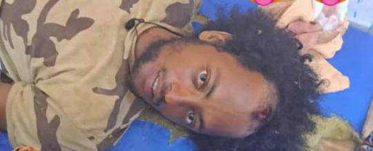 إصابة مرتزق تشادي في معركة “أم قعود” وسط إهمال طبي بمستوصف الشيخ موسى في نيالا